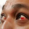 Eye