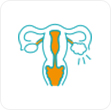 Bartholin Cyst Treatment