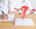Gyneocologic Cancer