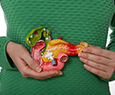 Pancreatic Cancer