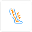 Varicose Vein